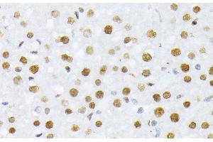 Immunohistochemistry of paraffin-embedded Rat liver using Phospho-Histone H2A(S129) Polyclonal Antibody at dilution of 1:100 (40x lens). (Histone H2A 抗体  (pSer129))