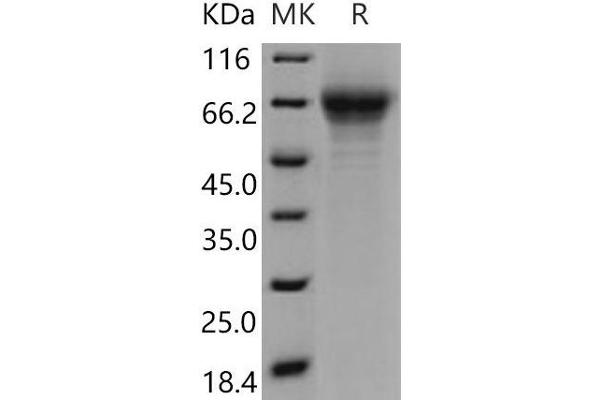 THSD1 Protein (His tag)
