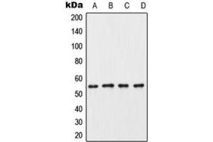 Western blot analysis of CK1 gamma 3 expression in HeLa (A), mouse testis (B), rat testis (C), PC12 (D) whole cell lysates. (CSNK1G3 抗体  (C-Term))