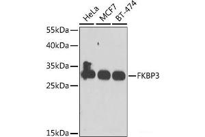 Western blot analysis of extracts of various cell lines using FKBP3 Polyclonal Antibody at dilution of 1:1000. (FKBP3 抗体)
