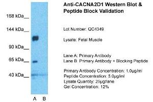 Host:  Rabbit  Target Name:  CACNA2D1  Sample Type:  Fetal Muscle  Lane A:  Primary Antibody  Lane B:  Primary Antibody + Blocking Peptide  Primary Antibody Concentration:  1ug/ml  Peptide Concentration:  5ug/ml  Lysate Quantity:  25ug/lane/Lane  Gel Concentration:  0. (CACNA2D1 抗体  (Middle Region))
