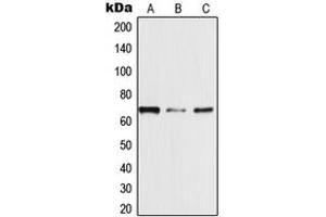 Western blot analysis of TRAF3IP3 expression in MDAMB453 (A), Jurkat (B), HeLa (C) whole cell lysates. (TRAF3IP3 抗体  (Center))