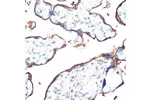 Immunohistochemistry of paraffin-embedded human placenta using CYPOR Rabbit mAb (ABIN7269151) at dilution of 1:100 (40x lens). (POR 抗体)