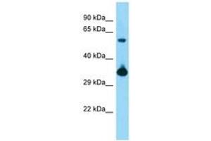 Image no. 1 for anti-BMI1 Polycomb Ring Finger Oncogene (BMI1) (AA 181-230) antibody (ABIN6748382) (BMI1 抗体  (AA 181-230))