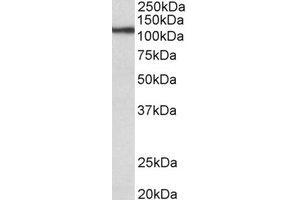 Western Blotting (WB) image for anti-Thyroid Peroxidase (TPO) (Internal Region) antibody (ABIN2464949) (Thyroperoxidase 抗体  (Internal Region))