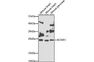 Western blot analysis of extracts of various cell lines, using KCNIP2 antibody (ABIN6128150, ABIN6142713, ABIN6142714 and ABIN6222906) at 1:1000 dilution. (KCNIP2 抗体  (AA 1-90))
