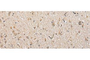 Immunohistochemistry of paraffin-embedded Human brain tissue using CSRP3 Polyclonal Antibody at dilution of 1:40(x200) (CSRP3 抗体)