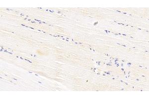 Detection of APOB100 in Bovine Skeletal muscle Tissue using Polyclonal Antibody to Apolipoprotein B100 (APOB100) (Apo-B100 抗体  (AA 4331-4567))