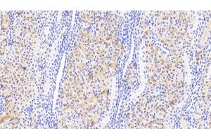 Detection of DDC in Human Kidney Tissue using Polyclonal Antibody to Dopa Decarboxylase (DDC)