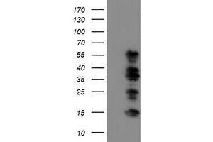 Western Blotting (WB) image for anti-WW Domain Containing Transcription Regulator 1 (WWTR1) antibody (ABIN1501763) (WWTR1 抗体)