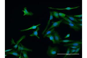 Immunofluorescence of purified MaxPab antibody to PSME1 on HeLa cell. (PSME1 抗体  (AA 1-249))