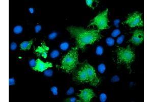 Anti-KATNB1 mouse monoclonal antibody (ABIN2455186) immunofluorescent staining of COS7 cells transiently transfected by pCMV6-ENTRY KATNB1 (RC201852). (KATNB1 抗体)