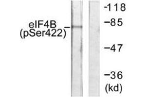 Western blot analysis of extracts from NIH-3T3 cells, using eIF4B (Phospho-Ser422) Antibody. (EIF4B 抗体  (pSer422))