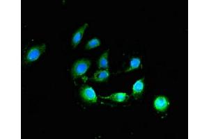 Immunofluorescence (IF) image for anti-B-Cell CLL/lymphoma 2 (BCL2) (AA 31-80) antibody (ABIN7144455)