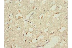 Immunohistochemistry of paraffin-embedded human brain tissue using ABIN7149271 at dilution of 1:100