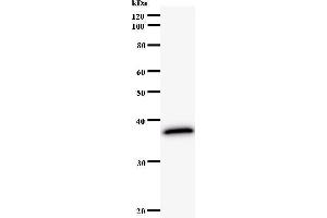 Western Blotting (WB) image for anti-Nei Endonuclease VIII-Like 3 (NEIL3) antibody (ABIN931131) (NEIL3 抗体)