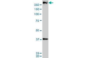 PARC monoclonal antibody (M01), clone 3F7 Western Blot analysis of PARC expression in A-431 (CUL9 抗体  (AA 918-1025))