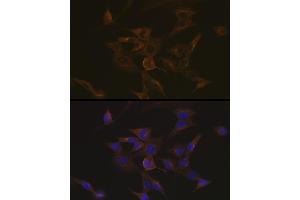 Immunofluorescence analysis of NIH-3T3 cells using EB3/M Rabbit mAb (ABIN7268535) at dilution of 1:100 (40x lens). (MAPRE3 抗体)