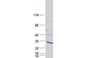 Western Blotting (WB) image for Adenylate Kinase 3 (AK3) protein (Myc-DYKDDDDK Tag) (ABIN2714403)