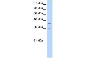 WB Suggested Anti-PCBP4 Antibody Titration:  1. (PCBP4 抗体  (Middle Region))