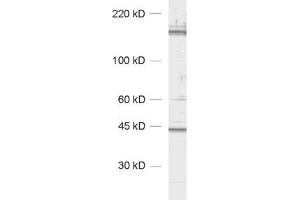 Western Blotting (WB) image for anti-CAP-GLY Domain Containing Linker Protein 1 (CLIP1) (AA 1283-1438) antibody (ABIN1742486) (CLIP1 抗体  (AA 1283-1438))