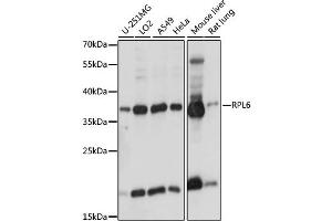 Western blot analysis of extracts of various cell lines, using RPL6 antibody. (RPL6 抗体)