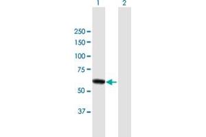 Western Blot analysis of DPYSL4 expression in transfected 293T cell line by DPYSL4 MaxPab polyclonal antibody. (DPYSL4 抗体  (AA 1-572))