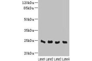 Western blot All lanes: C4orf33 antibody at 4 μg/mL Lane 1: Mouse kidney tissue Lane 2: Mouse liver tissue Lane 3: Mouse lung tissue Lane 4: Mouse heart tissue Secondary Goat polyclonal to rabbit IgG at 1/10000 dilution Predicted band size: 24 kDa Observed band size: 24 kDa (C4orf33 抗体  (AA 1-199))