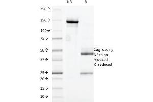 SDS-PAGE Analysis Purified CD32 Mouse Monoclonal Antibody (7. (FCGR2A 抗体)