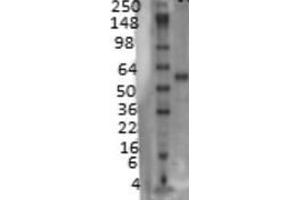 Western blot detection of VACHT on rat membrane tissues using a 1:1000 dilution of SLC18A3 / VACHT Cat. (SLC18A3 抗体  (AA 521-532))