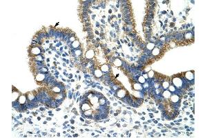 Copine I antibody was used for immunohistochemistry at a concentration of 4-8 ug/ml to stain Epithelial cells of intestinal villus (arrows) in Human Intestine . (CPNE1 抗体  (N-Term))