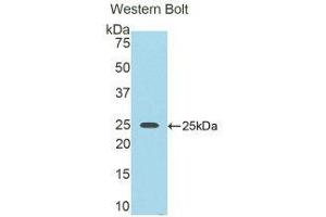 Western Blotting (WB) image for anti-Nexilin (NEXN) (AA 409-605) antibody (ABIN1859994) (NEXN 抗体  (AA 409-605))