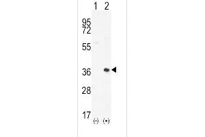 Western blot analysis of PIM2 (arrow) using rabbit polyclonal PIM2 Antibody  (ABIN392442 and ABIN2842040). (PIM2 抗体  (C-Term))