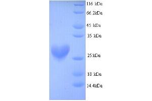 SDS-PAGE (SDS) image for NQO2 (NQO2) (AA 1-231), (full length) protein (His tag) (ABIN5714492)