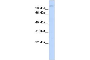 WB Suggested Anti-TXNDC16 Antibody Titration:  0. (TXNDC16 抗体  (N-Term))