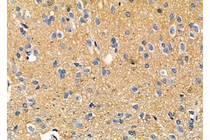 ABIN6257800 and ABIN6273894 at 1/100 staining Rat brain tissue by IHC-P. (NPBWR2 抗体  (C-Term))