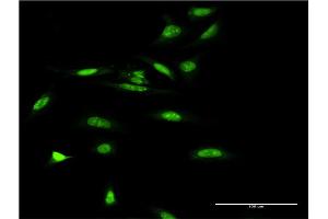 Immunofluorescence (IF) image for anti-SWI/SNF Related, Matrix Associated, Actin Dependent Regulator of Chromatin, Subfamily A, Member 5 (SMARCA5) (AA 59-147) antibody (ABIN521926)