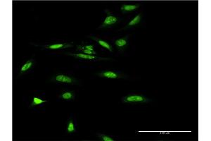 Immunofluorescence of monoclonal antibody to SMARCA5 on HeLa cell. (SMARCA5 抗体  (AA 59-147))