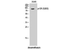 Western Blotting (WB) image for anti-GR (pSer203) antibody (ABIN3180436) (GR (pSer203) 抗体)