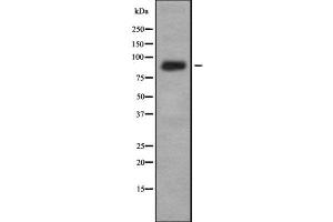 Western blot analysis IL-4R alpha using K562 whole cell lysates (IL4 Receptor 抗体  (N-Term))