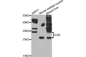 Western blot analysis of extracts of various cell lines, using CA8 antibody (ABIN5975602) at 1/1000 dilution. (CA8 抗体)