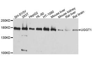 Western blot analysis of extracts of various cell lines, using UGGT1 antibody. (UGGT1 抗体  (AA 1456-1555))