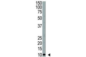 Western blot analysis of anti-Ubiquitin antibody and HeLa cell lysate