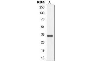 Western blot analysis of MC4 Receptor expression in EOC20 (A) whole cell lysates. (MC4R 抗体  (C-Term))