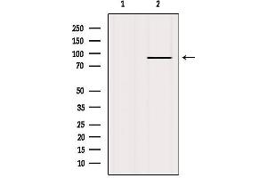 Western blot analysis of extracts from HepG2, using FGFR2 Antibody. (FGFR2 抗体  (C-Term))