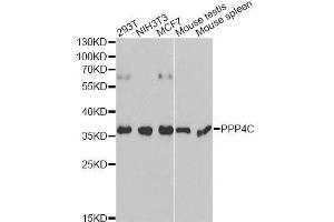 Western blot analysis of extracts of various cell lines, using PPP4C antibody. (PPP4C 抗体  (AA 1-307))