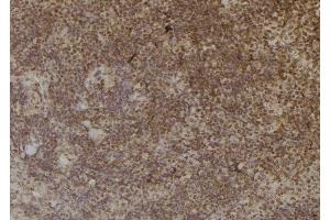 ABIN6257013 and ABIN6274965 at 1/100 staining Mouse spleen tissue by IHC-P. (CBR3 抗体  (C-Term))