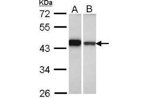 WB Image Sample (30 ug of whole cell lysate) A: A431 , B: Hela 10% SDS PAGE antibody diluted at 1:1000 (GIPC1 抗体  (C-Term))