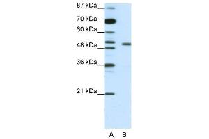 KCNAB2 antibody used at 1. (KCNAB2 抗体  (Middle Region))