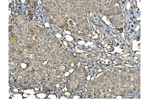 IHC analysis of PDIA6 using anti-PDIA6 antibody (ABIN7600553). (PDIA6 抗体  (AA 20-440))